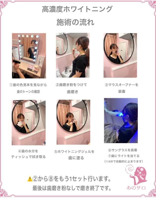 高濃度ホワイトニング