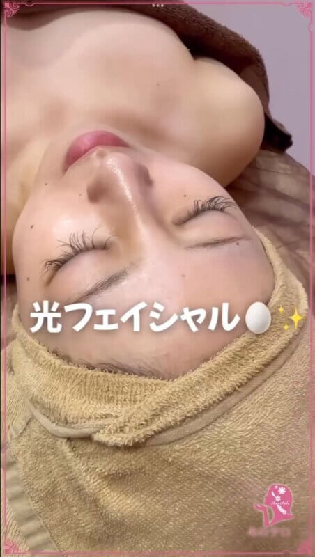 光フェイシャル💆💛